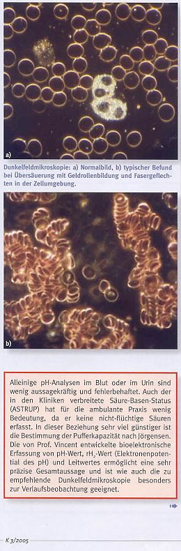Artikel: Krebszellen mit Mantel - Grundlagen zum Säure-Basen-Haushalt im Rahmen der Biologischen Krebsbehandlung, Seite 5 mit Bildern einer Dunkelfeldmikroskopie